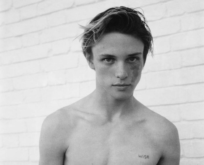 9X có bớt trên mặt thành ngôi sao hàng đầu của hãng thời trang Versace