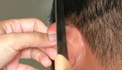 Cô gái bị chích điện, cắt vành tai vì trả nợ chậm