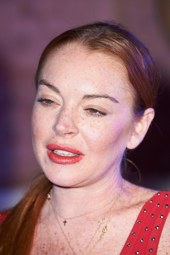 Lindsay Lohan: Ngôi sao nghiện phẫu thuật thẩm mỹ và già cỗi ở tuổi 32
