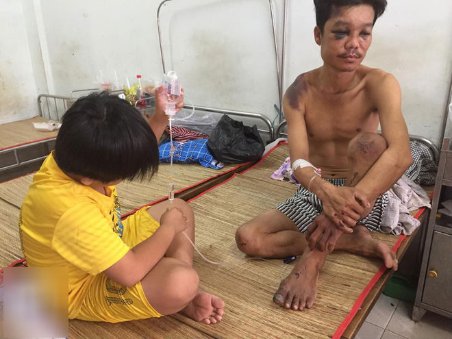 Mẹ bỏ đi lấy chồng, bé trai 12 tuổi nghỉ học vào bệnh viện chăm cha khờ bị tai nạn mà không có tiền cứu chữa