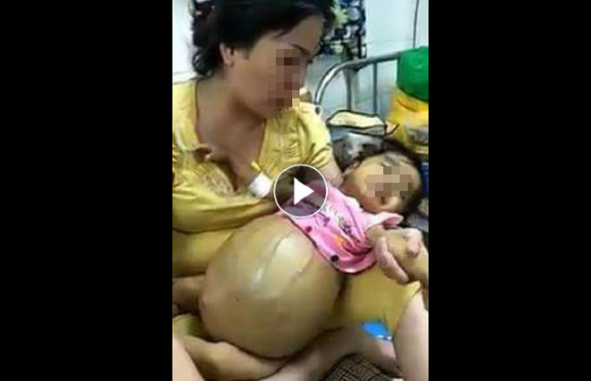 Cảnh báo: Bé gái ung thư tụy đã mất 3 tháng vẫn bị kẻ xấu nhẫn tâm đưa hình ảnh lên mạng trục lợi