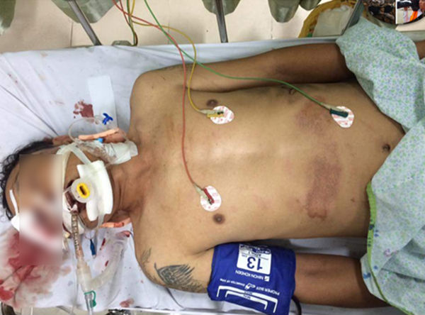 Hà Nội: Công an đang xác minh danh tính nạn nhân vụ tai nạn kinh hoàng trong đêm