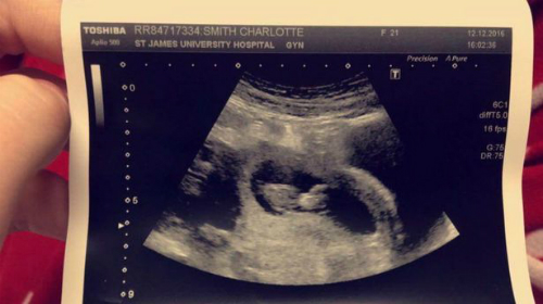 Cái chết của cô gái ung thư cảnh báo bà bầu phải tầm soát bệnh