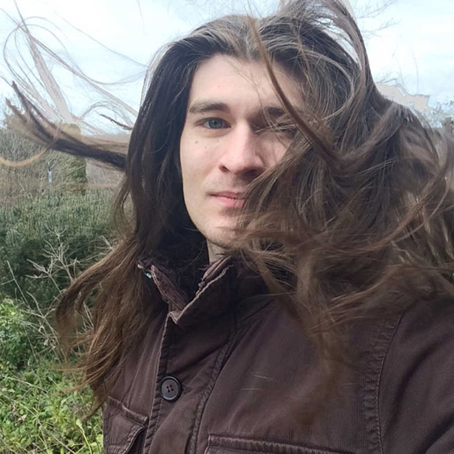 Giảm 32 kg, chàng trai trở nên nổi tiếng vì giống hoàng tử Disney