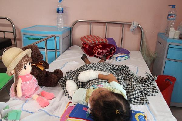 Sau 1 cơn sốt ban đêm, mẹ hoảng sợ thấy chân tay con gái 3 tuổi tím đen, hoại tử