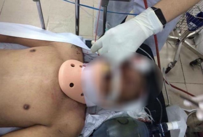 Vụ ô tô kéo lê người trên phố: Tài xế là ai?