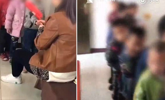 Bé 4 tuổi bị bỏng toàn thân ở trường mẫu giáo và sự thật gây phẫn nộ