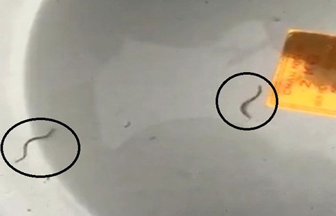 Phát hiện sinh vật lạ giống như đỉa trong nước máy ở Quảng Ninh