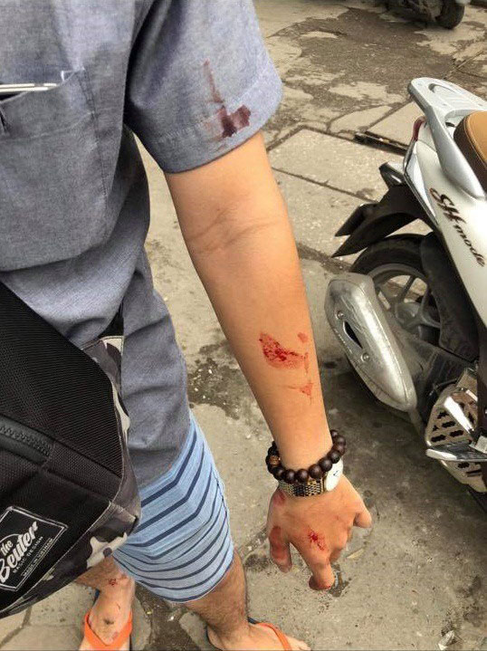 Hà Nội: Giám đốc đánh nữ sinh viên nhập viện vì đến đòi lại tiền cọc sau một tháng không được nhận lớp gia sư