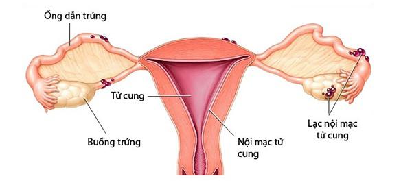 10 nguyên nhân chính gây vô sinh, người chưa có gia đình cũng nên biết để tránh