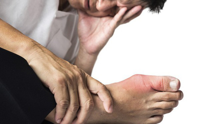 Ăn chay vẫn bị gút