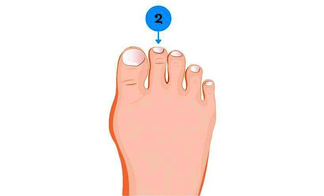 Soi ngay kích cỡ ngón chân để khám phá nhiều bí mật thú vị về tính cách của bản thân Soi ngay kích cỡ ngón chân để khám phá nhiều bí mật thú vị về tính cách của bản thân