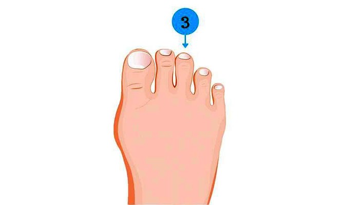 Soi ngay kích cỡ ngón chân để khám phá nhiều bí mật thú vị về tính cách của bản thân Soi ngay kích cỡ ngón chân để khám phá nhiều bí mật thú vị về tính cách của bản thân