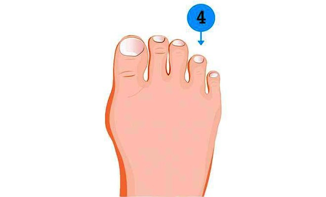 Soi ngay kích cỡ ngón chân để khám phá nhiều bí mật thú vị về tính cách của bản thân Soi ngay kích cỡ ngón chân để khám phá nhiều bí mật thú vị về tính cách của bản thân