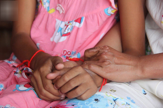 Con rể ghen với bố vợ, phóng hỏa đốt cả nhà khiến bố vợ tử vong, hai mẹ con bị phỏng không có tiền chạy chữa