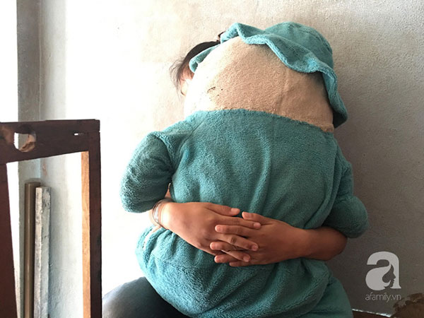 Vụ bé gái 11 tuổi câm điếc bị xe ôm hiếp dâm: Tìm thấy ADN nghi phạm trong vùng kín của bé gái