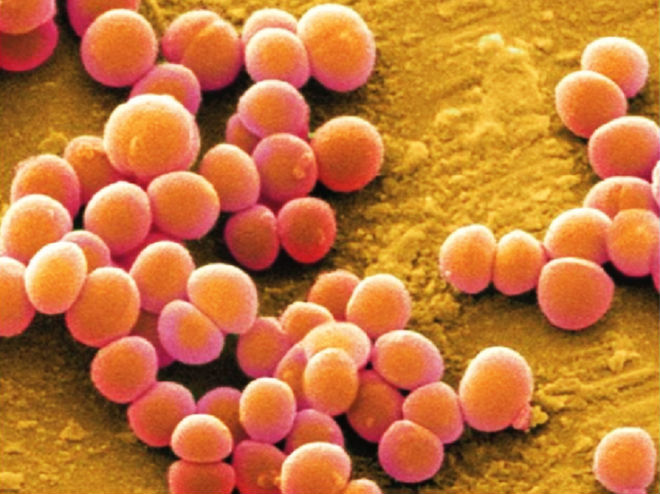 Té xe đạp, bé trai 11 tuổi bị nhiễm vi khuẩn tụ cầu vàng nguy kịch