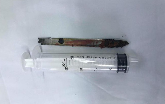 Lưỡi dao 13cm ‘ngủ quên’ ở lưng chiến sĩ công an suốt 11 năm