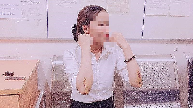 Vì sao tìm được tên cướp kéo lê cô gái hàng chục mét ở Q1?