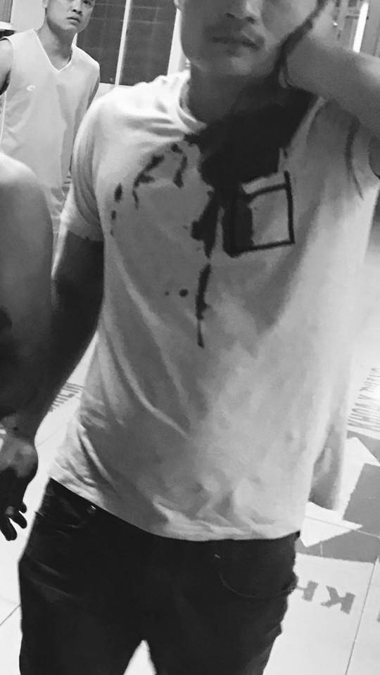 Quảng Ninh: Kinh hoàng 3 công nhân bị nhóm côn đồ xông vào công ty cứa cổ