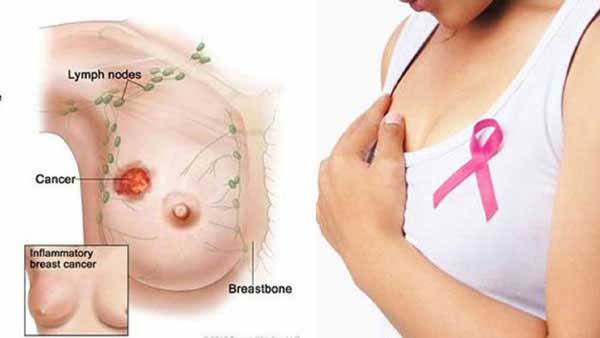 Đi ngủ muộn quá nhiều thì sớm muộn gì bạn cũng mắc những bệnh nguy hiểm này Đi ngủ muộn quá nhiều thì sớm muộn gì bạn cũng mắc những bệnh nguy hiểm này