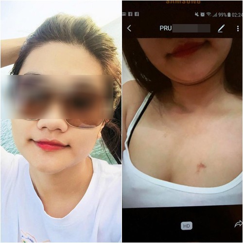 Vợ đánh ghen, bắt quả tang ảnh nóng nhưng vẫn bị tiểu tam thách thức: Phô ra thì xấu mặt chị chứ em thì bình thường!