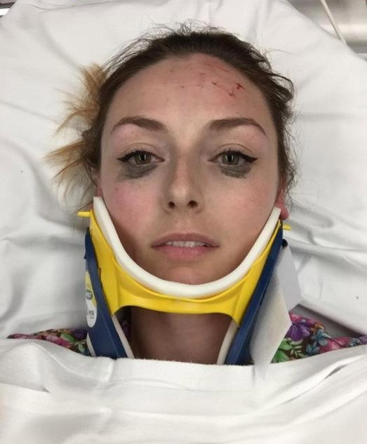 Cô gái gặp tai nạn xe vẫn không quên chụp ảnh review bút kẻ mắt