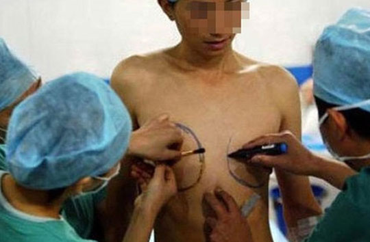 Quy trình phẫu thuật chuyển giới như thế nào?