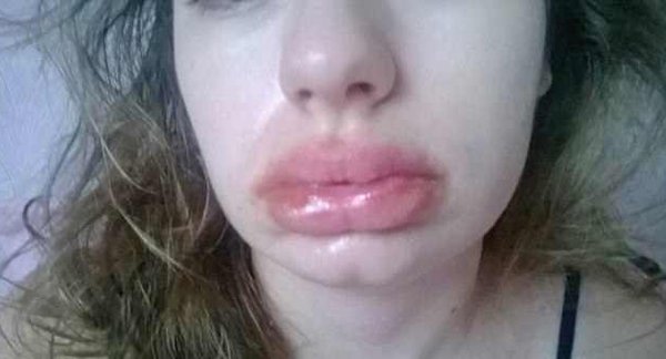 Cô gái xinh đẹp ngưng thở khi ăn thịt, tự giam mình khi trời nắng