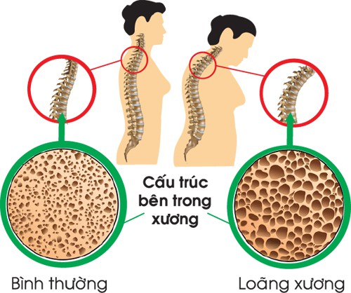 Đậu xanh - Thực phẩm vàng cho sức khỏe