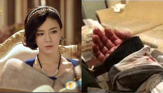 Sao nữ Tiếu ngạo giang hồ cứa cổ tay tự sát vì quy tắc ngầm showbiz?