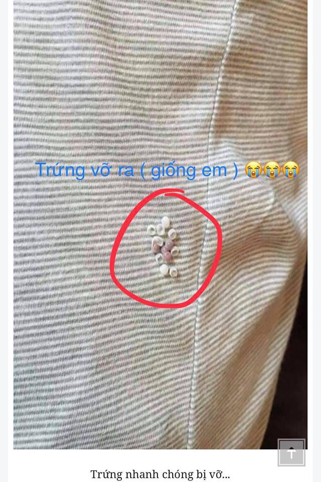 Cẩn trọng với quái vật đẻ trứng, hoành hành trong mùa hè gây bệnh viêm da, mù mắt, dễ nhầm lẫn với bệnh zona