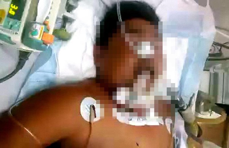 Bị chém tử vong vì tưởng đi trộm chó