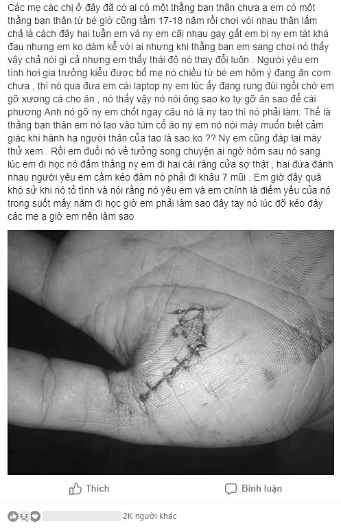 Cô gái kể chuyện bạn thân đấm bạn trai gãy 2 chiếc răng, chị em chẳng xót xa mà tư vấn bất ngờ Cô gái kể chuyện bạn thân đấm bạn trai gãy 2 chiếc răng, chị em chẳng xót xa mà tư vấn bất ngờ