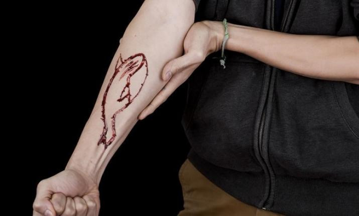 Người sống sót từ Cá voi xanh: Giãy giụa thoát chết vào ngày thứ 50