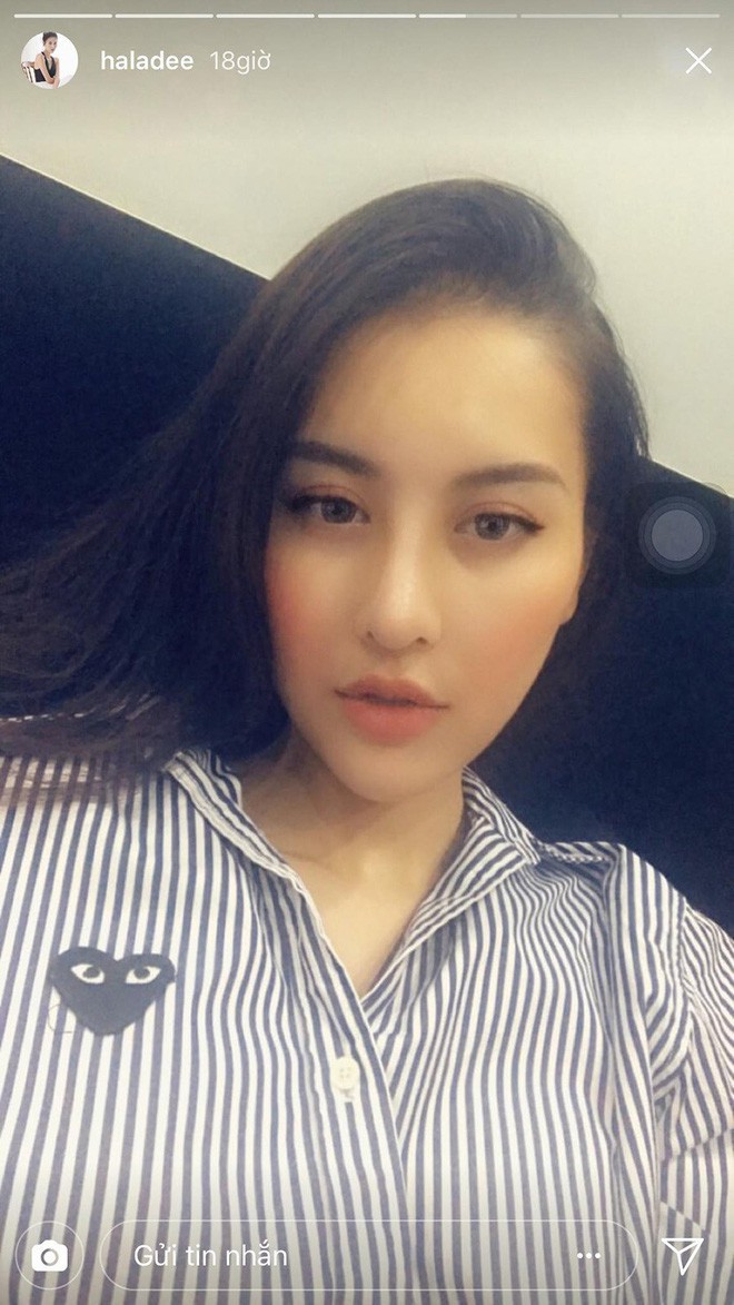 Những người đẹp Vbiz đang mải miết chạy đua với mốt cằm dài nhọn hoắt Những người đẹp Vbiz đang mải miết chạy đua với mốt cằm dài nhọn hoắt