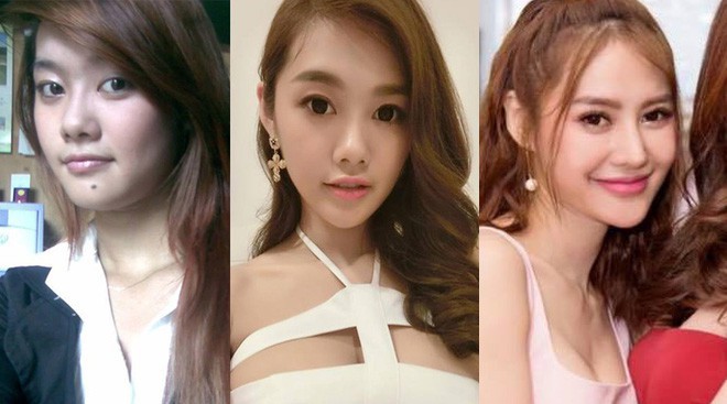 Những người đẹp Vbiz đang mải miết chạy đua với mốt cằm dài nhọn hoắt