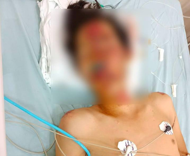 Nam thanh niên 17 tuổi nhập viện sau cuộc rượt đuổi của CSGT