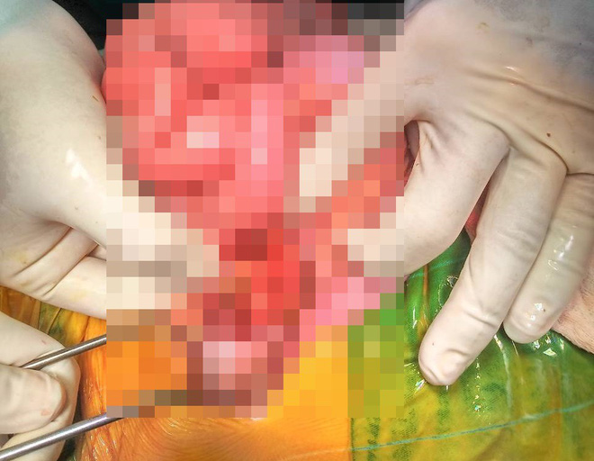 Phụ huynh quên tắt máy, bé trai 2 tuổi vặn ga xe máy đè thủng ruột bạn cùng lớp