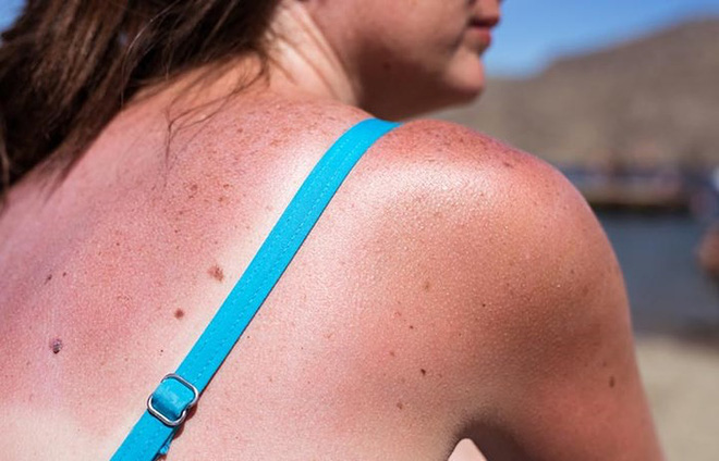 Uống nhiều nước chanh không thực sự tốt như mọi người vẫn nghĩ