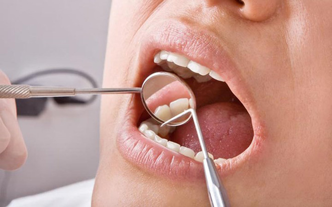 Uống nhiều nước chanh không thực sự tốt như mọi người vẫn nghĩ