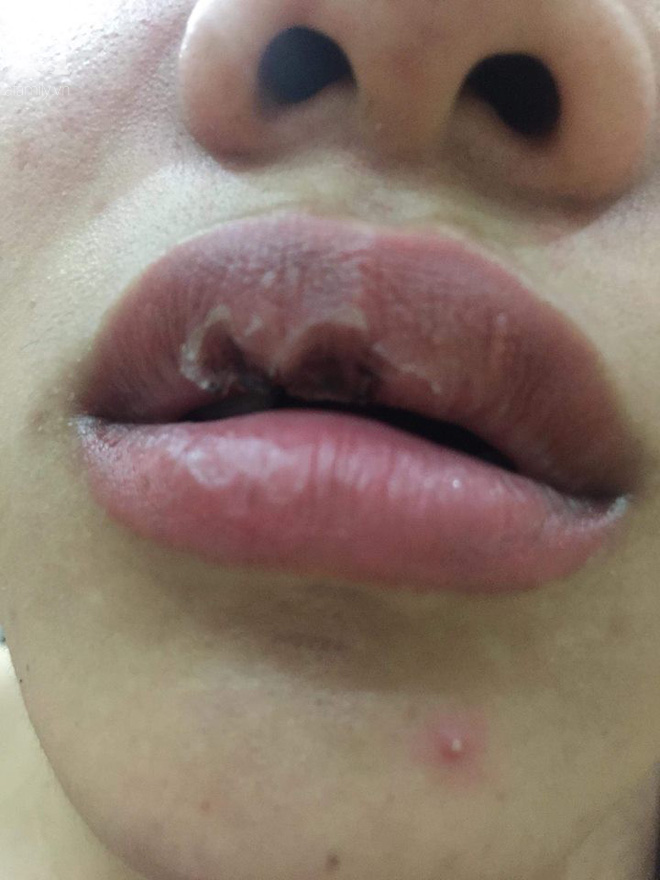 Hà Nội: Lời cầu cứu của cô gái bị bạn trai ngoại quốc đánh đập, tung clip nóng lên mạng