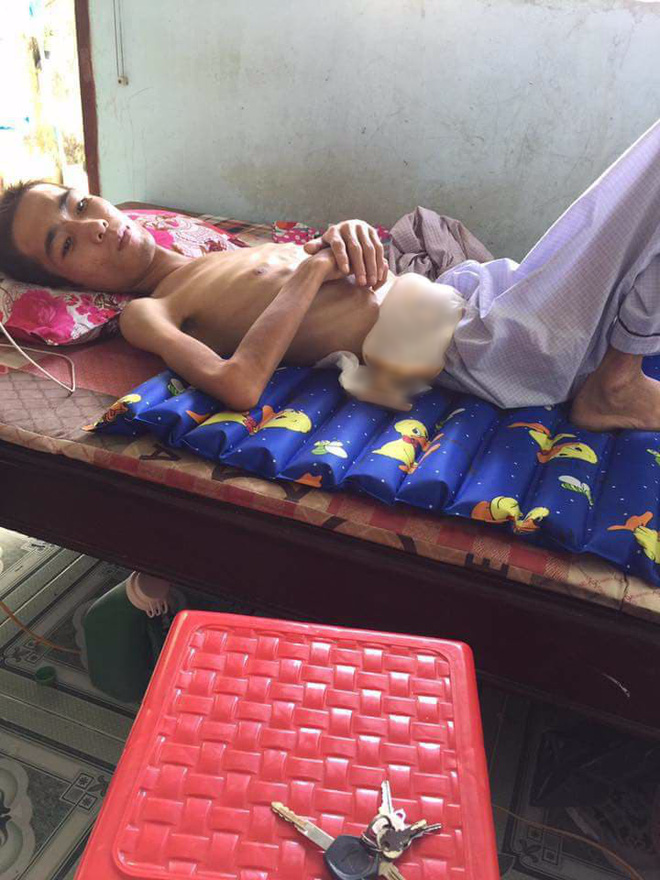 Thanh niên hồi phục thần kỳ sau khi mắc hàng loạt bệnh hiểm nghèo nhờ tinh thần lạc quan