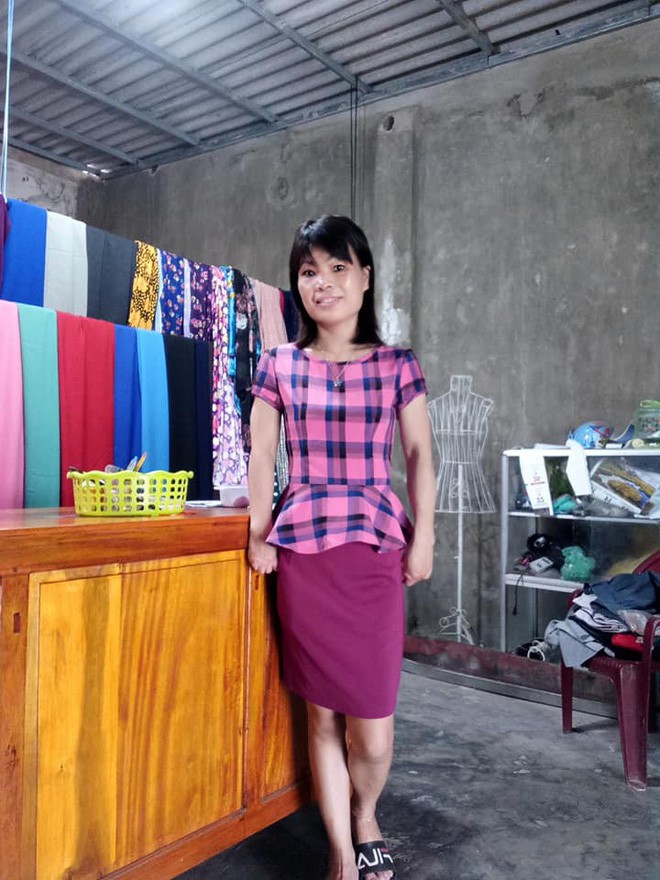 Em sống không tiếc một kiếp người: Đám cưới xúc động của cô dâu khuyết tật tay chân và chú rể phải nhờ bạn đi đón dâu hộ