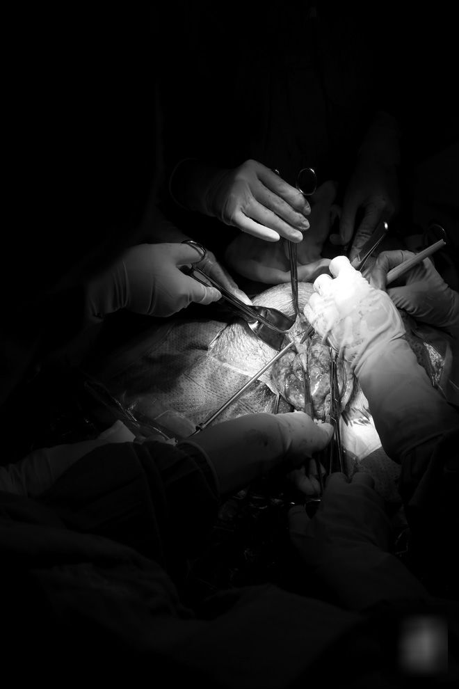 6 giờ ròng rã cứu mạng người phụ nữ mang khối u buồng trứng lớn nhất Việt Nam