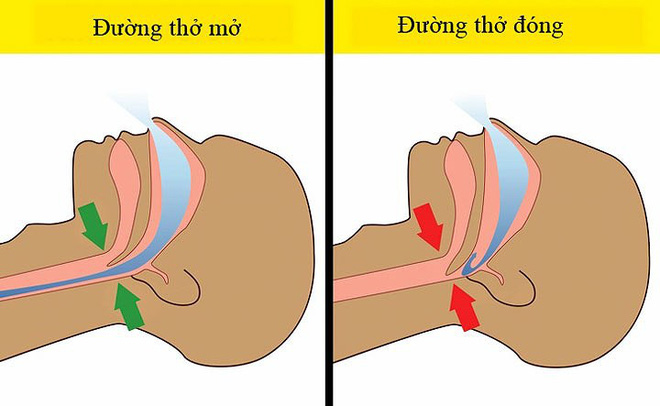 7 lý do khiến bạn thường xuyên bị tỉnh giấc ban đêm 7 lý do khiến bạn thường xuyên bị tỉnh giấc ban đêm