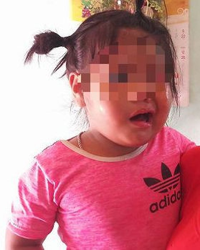 Cô giáo bị tố đánh trẻ liệt dây thần kinh, méo mồm tạm nghỉ việc