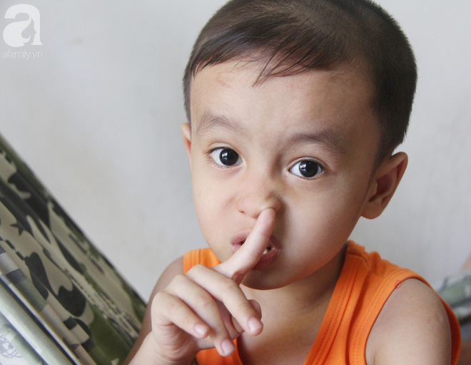 Bị điện giật cháy người không có tiền chạy chữa, bố xót xa nhìn con trai 4 tuổi không nhận ra mình