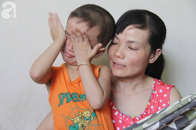 Bị điện giật cháy người không có tiền chạy chữa, bố xót xa nhìn con trai 4 tuổi không nhận ra mình