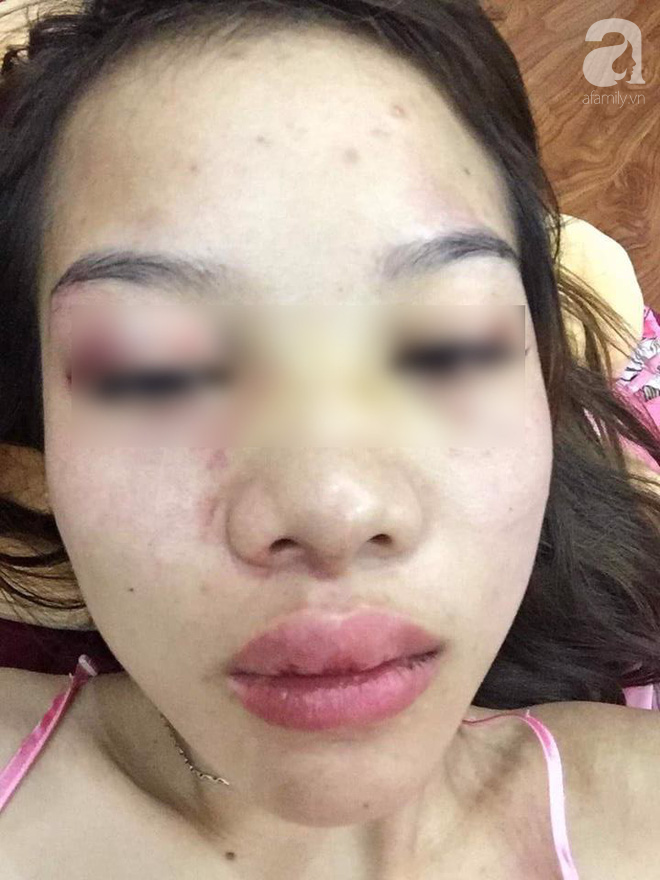 Cô gái bị bạn trai ngoại quốc đánh, tung clip nóng lên mạng: Tôi vì có tình cảm nên luôn chấp nhận những trận đánh, tôi chấp nhận vì tình yêu Cô gái bị bạn trai ngoại quốc đánh, tung clip nóng lên mạng: Tôi vì có tình cảm nên luôn chấp nhận những trận đánh, tôi chấp nhận vì tình yêu